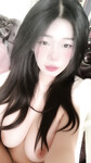 Múp bướm